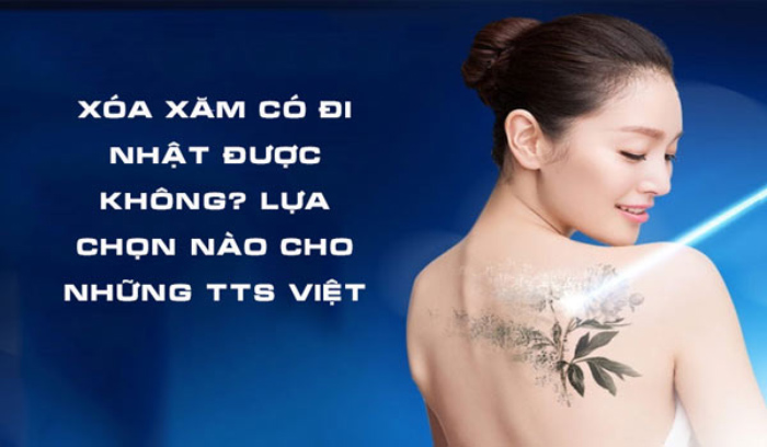 Đã từng xăm và xóa xăm có đi Nhật được không?